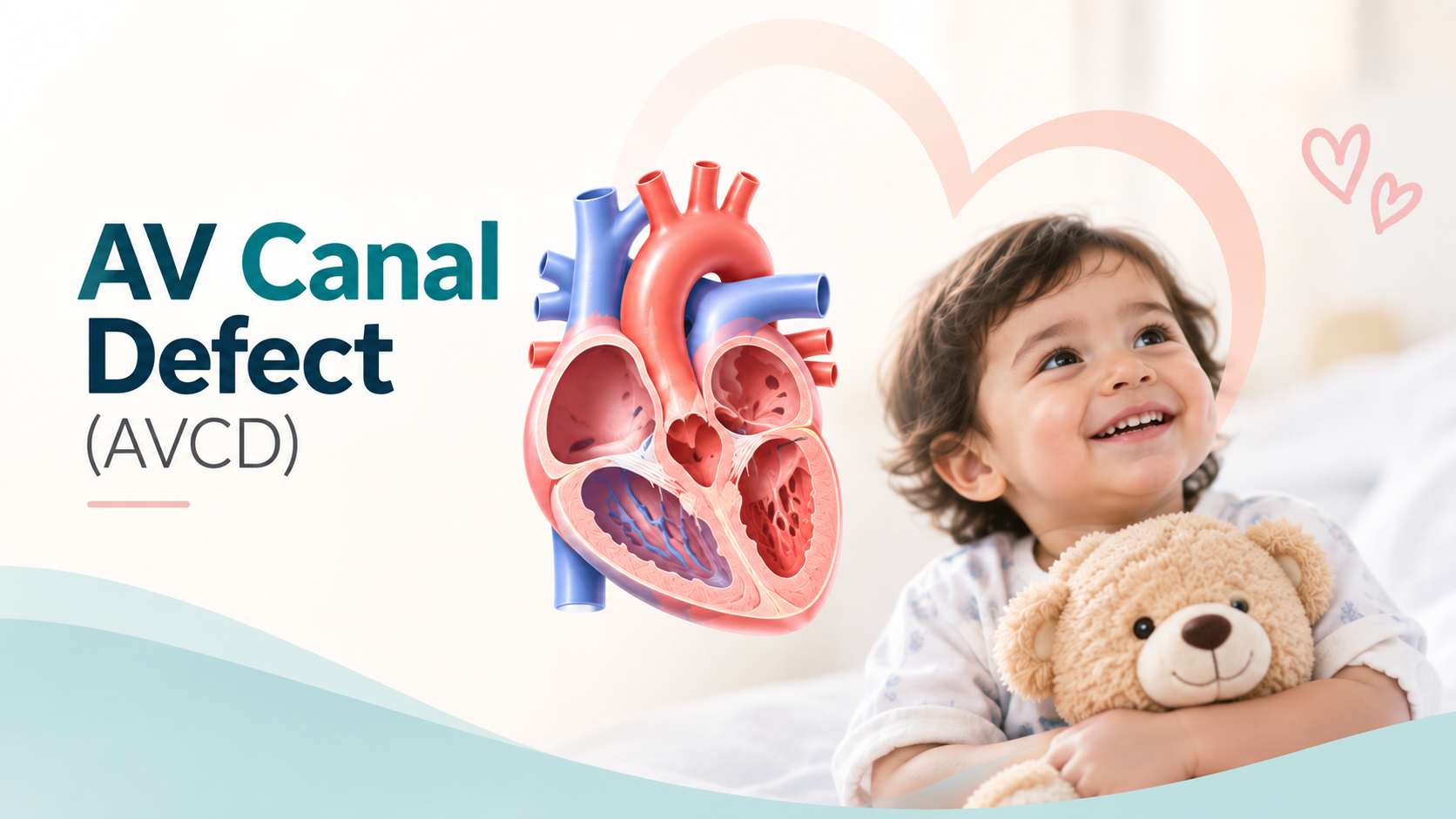 AV canal defect (AVCD)